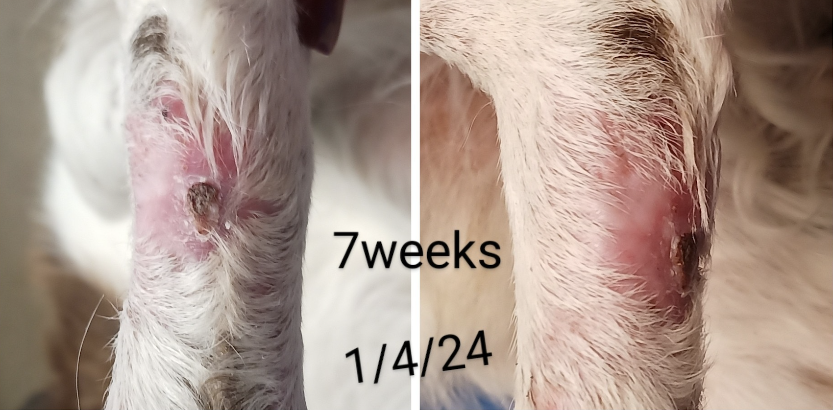 Case Study: Open Wound Management